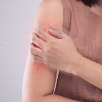 Infection triggers Psoriasis